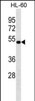 Rabbit Polyclonal Antibody to NAAA