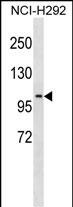 Rabbit Polyclonal Antibody to PDE4C (N-term)
