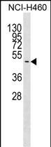 Rabbit Polyclonal Antibody to GNAS