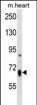 Rabbit Polyclonal Antibody to HBS1L