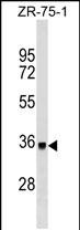 Mouse Monoclonal Antibody to DYT1