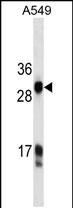 Mouse Monoclonal Antibody to HKLK3 (C234)