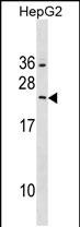 Rabbit Polyclonal Antibody to RAB5B