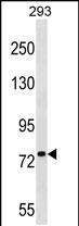 Rabbit Polyclonal Antibody to PLK1S1 (N-term)