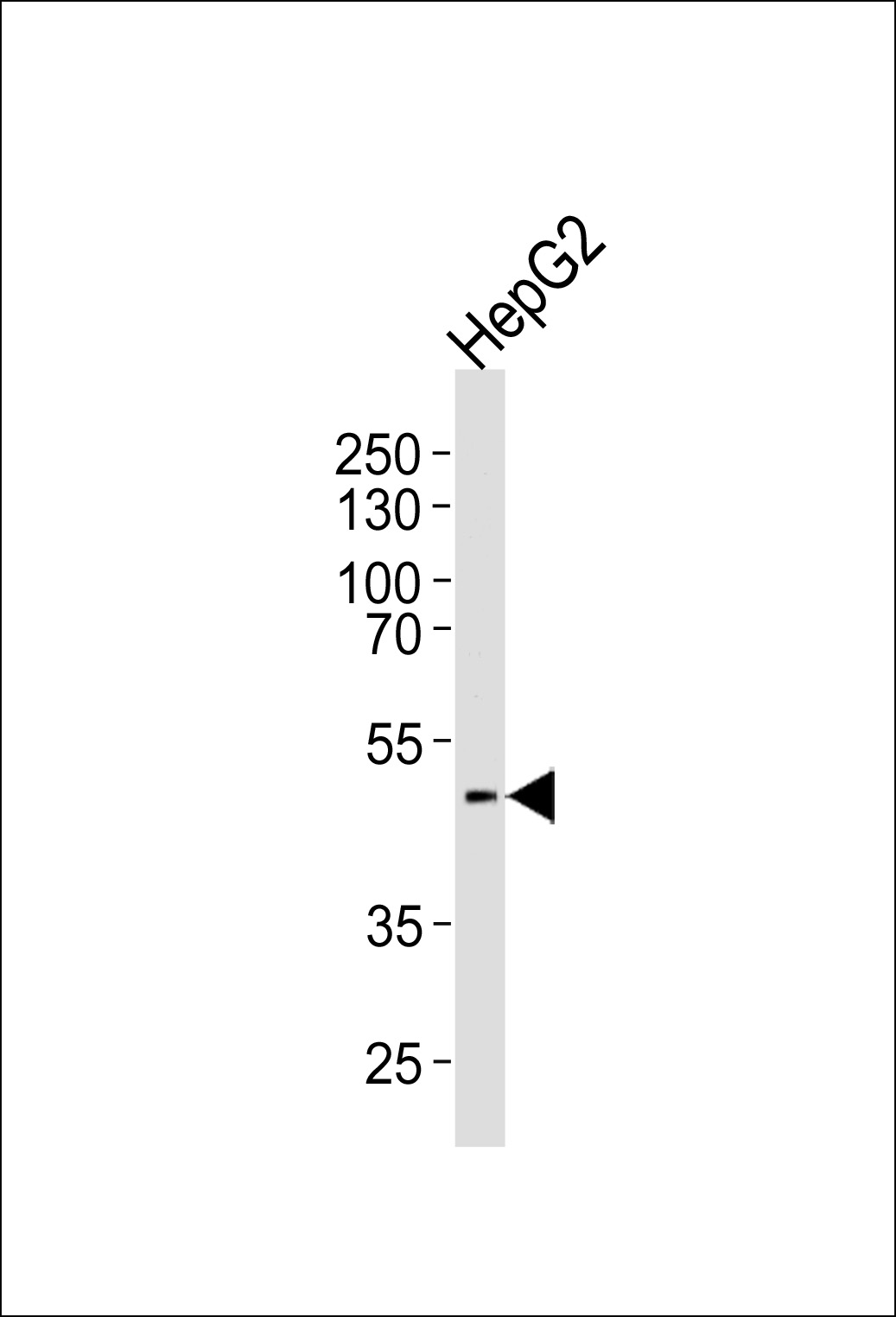 Rabbit Polyclonal Antibody to HHCM