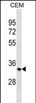 Rabbit Polyclonal Antibody to RAB40C