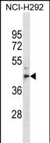Rabbit Polyclonal Antibody to MPPE1