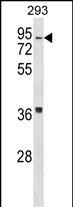 Rabbit Polyclonal Antibody to HIRIP3