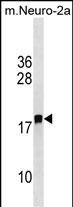 Rabbit Polyclonal Antibody to LDOC1L
