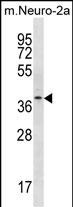 Rabbit Polyclonal Antibody to THOC6
