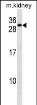 Rabbit Polyclonal Antibody to REEP5