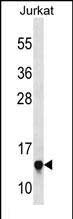 Rabbit Polyclonal Antibody to RPS23 (N-term)
