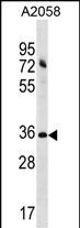 Rabbit Polyclonal Antibody to ACBD6 (N-term)