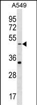 Rabbit Polyclonal Antibody to GABRR2 (N-term)