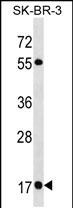 Rabbit Polyclonal Antibody to RAB19 (N-term)