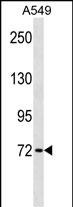 Rabbit Polyclonal Antibody to KBTBD7