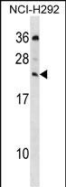 Rabbit Polyclonal Antibody to MED19