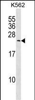 Rabbit Polyclonal Antibody to MYL6B