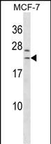 Rabbit Polyclonal Antibody to SAP30L