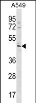 Rabbit Polyclonal Antibody to TBC1D20
