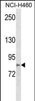 Rabbit Polyclonal Antibody to MCTP2 (N-term)