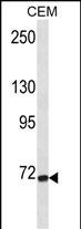 Rabbit Polyclonal Antibody to FZD3