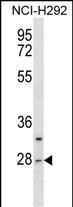 Rabbit Polyclonal Antibody to CTRL