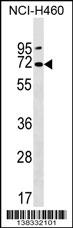Rabbit Polyclonal Antibody to PKD2L2