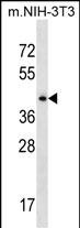 Rabbit Polyclonal Antibody to SEPT6