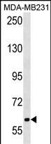Rabbit Polyclonal Antibody to TRPC4AP (N-term)