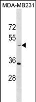 Rabbit Polyclonal Antibody to TAPBP (N-term)
