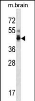 Rabbit Polyclonal Antibody to PPP1R7