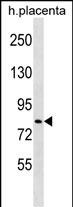 Rabbit Polyclonal Antibody to HECTD2 (N-term)