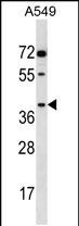 Rabbit Polyclonal Antibody to AKR1E2