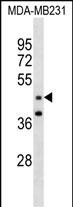 Rabbit Polyclonal Antibody to GRAMD3 (N-term )