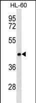 Rabbit Polyclonal Antibody to CLN8