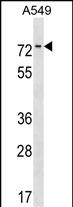 Rabbit Polyclonal Antibody to HKR1 (N-term)