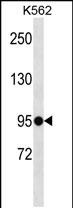 Rabbit Polyclonal Antibody to ELFN1