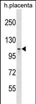 Rabbit Polyclonal Antibody to MMS19