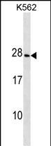 Rabbit Polyclonal Antibody to CRYGD