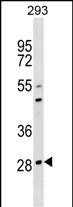 Rabbit Polyclonal Antibody to OSCAR