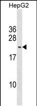 Rabbit Polyclonal Antibody to PMS2L5