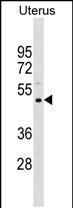 Rabbit Polyclonal Antibody to PRAMEF11