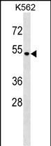 Rabbit Polyclonal Antibody to SMAP1 (N-term)