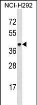 Rabbit Polyclonal Antibody to VSIG4