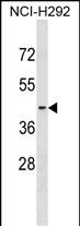 Rabbit Polyclonal Antibody to S1PR2