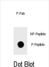 Rabbit Polyclonal Antibody to Phospho-IKKB(S675)
