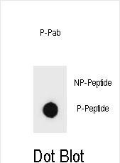 Rabbit Polyclonal Antibody to Phospho-PTEN(S362)