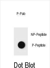 Rabbit Polyclonal Antibody to Phospho-PTEN(T382)