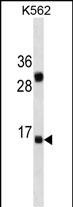 Mouse Monoclonal Antibody to IL2